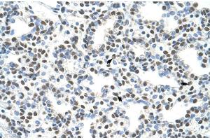 Human Lung; AKAP8L antibody - C-terminal region in Human Lung cells using Immunohistochemistry