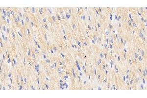 Detection of Hsp60 in Human Cardiac Muscle Tissue using Polyclonal Antibody to Heat Shock Protein 60 (Hsp60) (HSPD1 antibody  (AA 1-573))