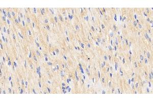 Detection of Hsp60 in Human Cardiac Muscle Tissue using Polyclonal Antibody to Heat Shock Protein 60 (Hsp60) (HSPD1 antibody  (AA 1-573))