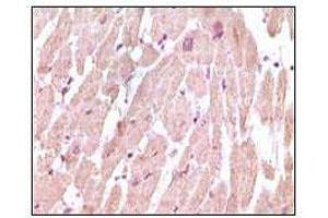 Immunohistochemical analysis of paraffin-embedded human normal cardiac muscle tissue, showing cytoplasmic localization using cTnI mouse mAb with DAB staining. (TNNI3 antibody)