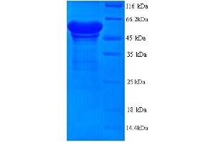 LINGO1 Protein (AA 37-555) (His tag)
