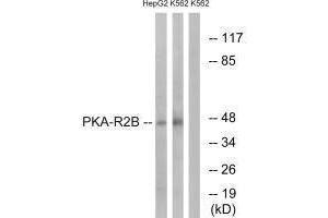 Western blot analysis of extracts from HepG2 cells and K562 cells, using PKA-R2β (Ab-113) antibody. (PRKAR2B antibody  (Ser113))