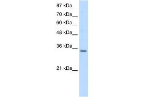 WB Suggested Anti-SNRPA Antibody Titration:  0. (SNRPA1 antibody  (Middle Region))