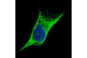 Fluorescent confocal image of SY5Y cells stained with Vimentin (C-term) antibody.