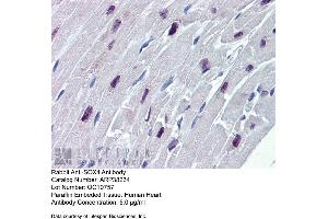 Immunohistochemistry (IHC) image for anti-SRY (Sex Determining Region Y)-Box 4 (SOX4) (N-Term) antibody (ABIN2780469) (SOX4 antibody  (N-Term))