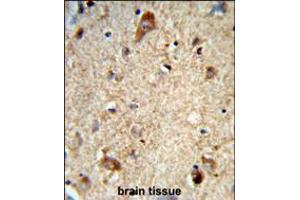 Formalin-fixed and paraffin-embedded human brain tissue reacted with DAB1 Antibody , which was peroxidase-conjugated to the secondary antibody, followed by DAB staining. (DAB1 antibody  (AA 189-216))