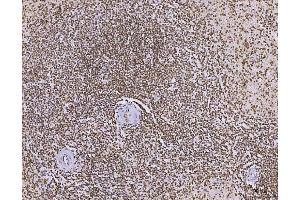 IHC analysis of C1orf77/FOP/CHTOP using anti-C1orf77/FOP/CHTOP antibody (ABIN7603201).