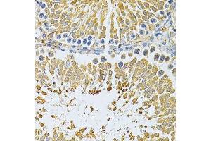 Immunohistochemistry of paraffin-embedded rat testis using PIBF1 Antibody. (PIBF1 antibody)