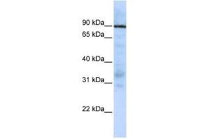 EWSR1 antibody used at 5 ug/ml to detect target protein. (EWSR1 antibody  (Middle Region))