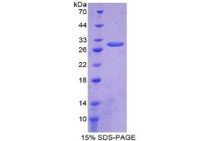 SDS-PAGE (SDS) image for tau Protein (AA 130-386) protein (His tag) (ABIN1878671)
