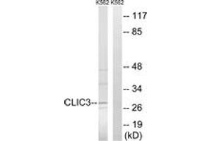 Western blot analysis of extracts from K562 cells, using CLIC3 Antibody. (CLIC3 antibody  (AA 21-70))
