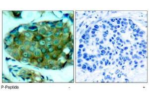 Image no. 1 for anti-Mechanistic Target of Rapamycin (serine/threonine Kinase) (mTOR) (pSer2448) antibody (ABIN196963) (MTOR antibody  (pSer2448))