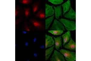 ABIN6264131 and ABIN6277486 staining  cells by IF/ICC.