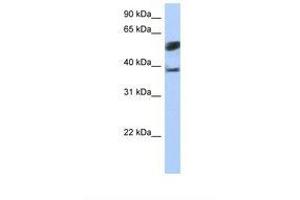Image no. 1 for anti-Speckle-Type POZ Protein-Like (SPOPL) (AA 74-123) antibody (ABIN6739277) (SPOPL antibody  (AA 74-123))