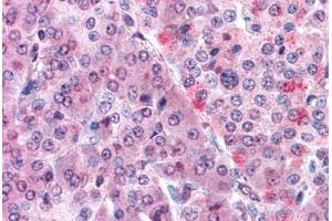 Human Pancreas: Formalin-Fixed, Paraffin-Embedded (FFPE) (Malectin antibody  (Internal Region))