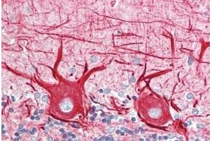 Human Brain, Cerebellum: Formalin-Fixed, Paraffin-Embedded (FFPE) (INA antibody)