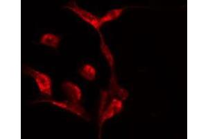 ABIN6275524 staining  HeLa cells by IF/ICC. (Septin 7 antibody  (C-Term))