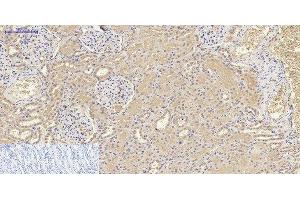 Immunohistochemistry of paraffin-embedded Human kidney tissue using IL8 Polyclonal Antibody at dilution of 1:200. (IL-8 antibody)