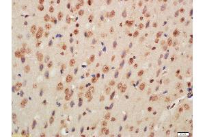 Formalin-fixed and paraffin embedded mouse brain labeled with Rabbit Anti-Histone H3 (Di Methyl K9) Polyclonal Antibody, Unconjugated  at 1:200 followed by conjugation to the secondary antibody and DAB staining (Histone 3 antibody  (H3K9me))
