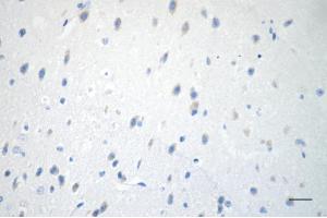 anti-Inositol-Tetrakisphosphate 1-Kinase (ITPK1) antibody