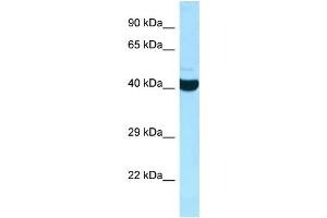 WB Suggested Anti-ADPRHL2 Antibody Titration: 1. (ADPRHL2 antibody  (C-Term))