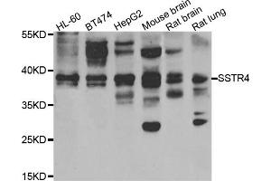 Western blot analysis of extracts of various cell lines, using SSTR4 antibody (ABIN5975458) at 1/1000 dilution. (SSTR4 antibody)