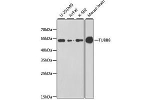 Western blot analysis of extracts of various cell lines, using TUBB8 antibody.