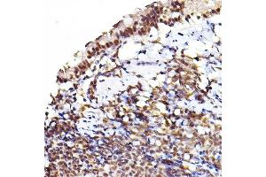 Immunohistochemistry of paraffin-embedded rat lung using Phospho--S473+-S474+-S472 Rabbit pAb (ABIN7265523) at dilution of 1:100 (40x lens). (AKT 1/2/3 antibody  (pSer472))