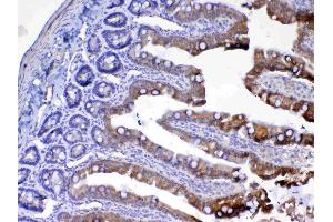 IHC analysis of UGT1A1 using anti-UGT1A1 antibody . (UGT1A1 antibody  (AA 316-533))