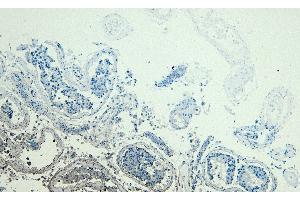 (ABIN184951) Negative Control showing staining of paraffin embedded Human Testis, with no primary antibody. (PARK7/DJ1 antibody  (C-Term))