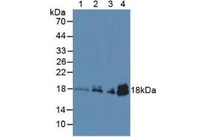 Figure. (TNNC1 antibody  (AA 1-161))