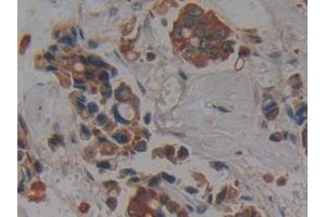 Immunohistochemistry (IHC) image for anti-Keratin 4 (KRT4) (AA 152-457) antibody (ABIN7431875)