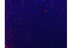 IF analysis of CD74 using anti-CD74 antibody (ABIN7602385).