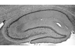 Adult rat hippocampus immunohistochemistry.