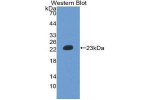 Western Blotting (WB) image for anti-Hemoglobin beta (HBB) (AA 1-147) antibody (ABIN1859125)