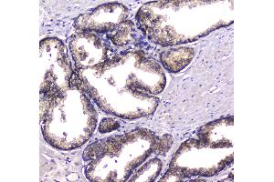 IHC analysis of HGD using anti-HGD antibody . (HGD antibody  (AA 374-445))
