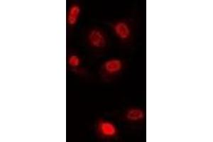 Immunofluorescent analysis of TLE1 staining in U2OS cells. (TLE1 antibody)