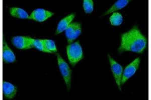 IF analysis of SND1 using anti-SND1 antibody (ABIN7600525).