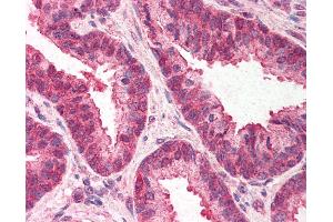Anti-TMED10 / TMP21 antibody IHC of human prostate. (TMED10 antibody  (C-Term))