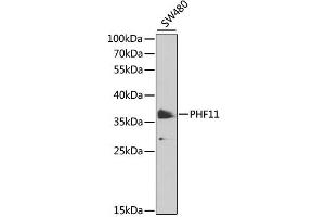 Western blot analysis of extracts of SW480 cells, using PHF11 antibody (ABIN6290738) at 1:1000 dilution. (PHF11 antibody)