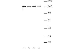 SMC3 antibody (pAb) tested by Western blot. (SMC3 antibody  (C-Term))
