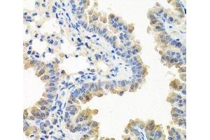 Immunohistochemistry of paraffin-embedded Mouse lung using LRG1 Polyclonal Antibody at dilution of 1:100 (40x lens). (LRG1 antibody)