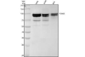 Western blot analysis of PDE4D using anti-PDE4D antibody (ABIN7605890).