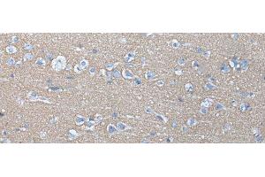 Immunohistochemistry of paraffin-embedded Human brain tissue using ETFB Polyclonal Antibody at dilution of 1:40(x200) (ETFB antibody)