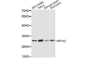 Western blot analysis of extracts of various cell lines, using PITX2 antibody. (PITX2 antibody)
