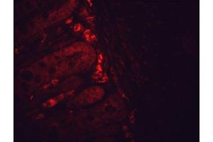 Immunohistochemistry (IHC) image for anti-Heat Shock Protein 90 (HSP90) antibody (ABIN361718)