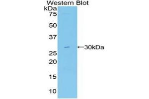 Western blot analysis of the recombinant protein. (MIB2 antibody  (AA 687-930))