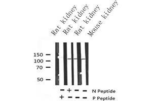 Western blot analysis of Phospho-PDGFR beta (Tyr1021) Antibody expression in Rat kidney and mouse kidney tissues lysates.