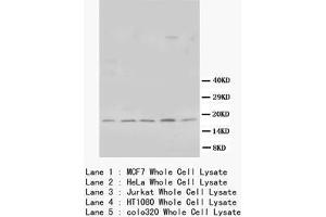 Western blot with Bcl-x/s Polyclonal Antibody (BCL2L1 antibody  (Middle Region))