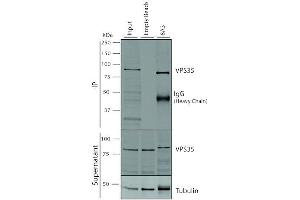 Immunoprecipitation analysis using Mouse Anti-VPS35 Monoclonal Antibody, Clone 8A3 (ABIN6932977). (VPS35 antibody  (PerCP))
